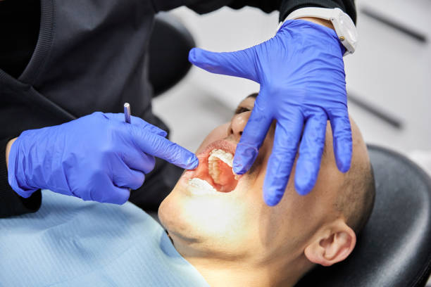 Best Emergency Tooth Extraction in Fresno, TX