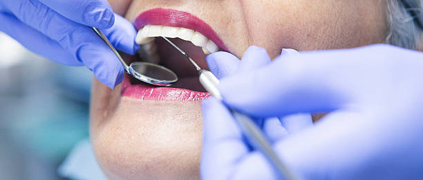Best Emergency Treatment for Dental Infections or Abscesses in Fresno, TX